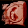 1st TRIMESTER