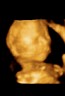 2nd TRIMESTER