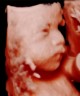 3rd TRIMESTER